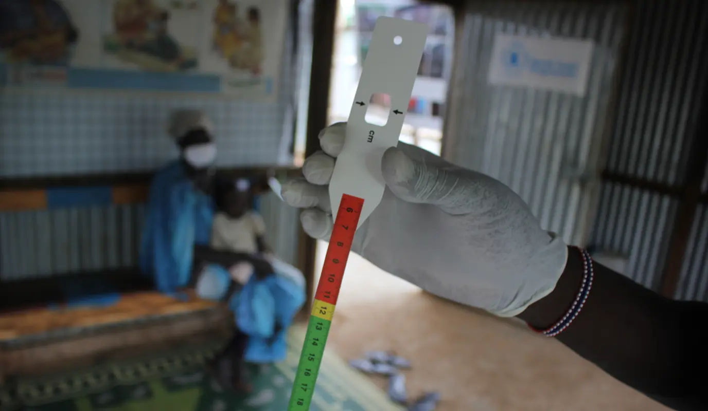 A MUAC band used to assess the nutritional status of children